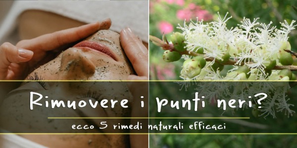 5 Rimedi naturali efficaci per rimuovere i punti neri